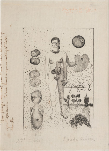 Фрида Кало. Фрида и аборт. 1932